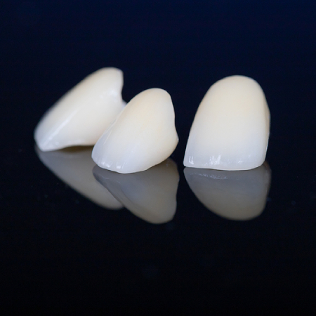 Restorative dental crowns