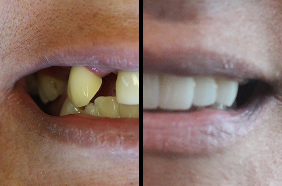 mary-ellen-thumbnail